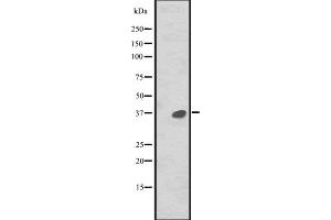 Western blot analysis of MAPRE2 expression in CEM cell line lysate ,The lane on the left is treated with the antigen-specific peptide. (MAPRE2 anticorps  (Internal Region))