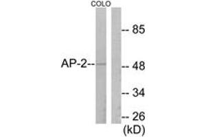 Western blot analysis of extracts from COLO205 cells, using AP-2 Antibody.