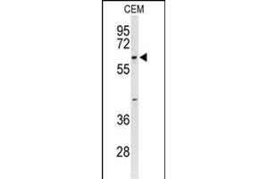 Western blot analysis of TCHP Antibody (Center) (ABIN653303 and ABIN2842803) in CEM cell line lysates (35 μg/lane).