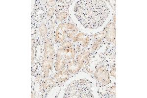 Immunohistochemical analysis of paraffin-embedded Human kidney tissue using B performed on the Leica® BOND RXm. (COL8a2 anticorps  (C-Term))