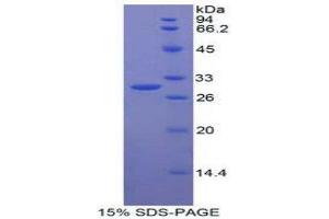 SDS-PAGE (SDS) image for Dimethylarginine Dimethylaminohydrolase 2 (DDAH2) (AA 31-265) protein (His tag) (ABIN2124639) (DDAH2 Protein (AA 31-265) (His tag))