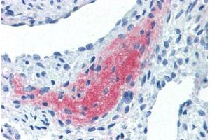 Human Uterus, Myometrium (formalin-fixed, paraffin-embedded) stained with LEFTY2 antibody ABIN337262 at 10 ug/ml followed by biotinylated anti-mouse IgG secondary antibody ABIN481714, alkaline phosphatase-streptavidin and chromogen. (LEFTY2 anticorps)