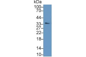 Detection of OSM in Mouse Skeletal muscle lysate using Polyclonal Antibody to Oncostatin M (OSM)