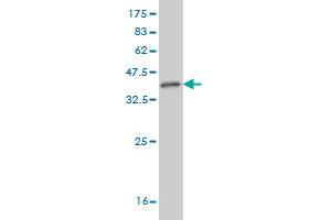 Western Blot detection against Immunogen (37.