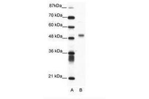 Image no. 1 for anti-Friend Leukemia Virus Integration 1 (FLI1) (N-Term) antibody (ABIN202560) (FLI1 anticorps  (N-Term))