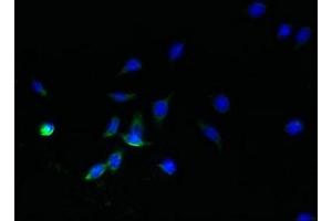 Immunofluorescent analysis of HepG2 cells using ABIN7170902 at dilution of 1:100 and Alexa Fluor 488-congugated AffiniPure Goat Anti-Rabbit IgG(H+L)