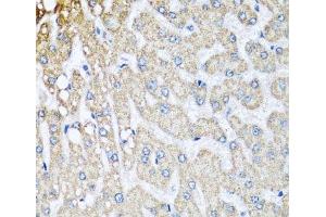 Immunohistochemistry of paraffin-embedded Human liver damage using COX5B Polyclonal Antibody at dilution of 1:100 (40x lens).