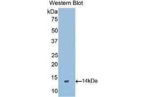 Western blot analysis of the recombinant protein. (GNRH1 anticorps  (AA 25-92))