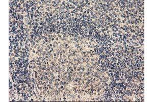 Image no. 1 for anti-Tubulin Folding Cofactor E-Like (TBCEL) antibody (ABIN1501326)