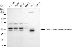 anti-Catechol-O-Methyltransferase (COMT) antibody
