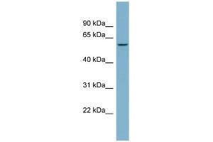 WB Suggested Anti-PPP5C Antibody Titration: 0. (PP5 anticorps  (N-Term))