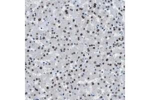 Immunohistochemical staining of human liver with OGFR polyclonal antibody  shows nuclear positivity in hepatocytes at 1:50-1:200 dilution. (OGFR anticorps)