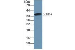 Western blot analysis of recombinant Rat CAPN1. (CAPNL1 anticorps  (AA 387-694))