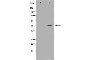 Western blot analysis of Hela whole cell lysates, using IRF5  Antibody. (IRF5 anticorps  (C-Term))