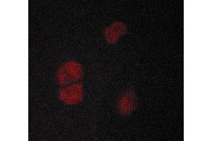 anti-Adrenergic, beta-2-, Receptor, Surface (ADRB2) (C-Term) antibody