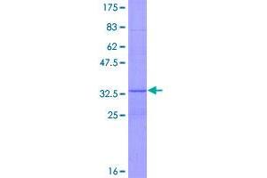 Image no. 1 for Endoplasmic Reticulum To Nucleus Signaling 1 (ERN1) (AA 1-70) protein (GST tag) (ABIN1353082)