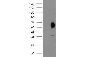 Western Blotting (WB) image for anti-Activating Signal Cointegrator 1 Complex Subunit 1 (ASCC1) antibody (ABIN1496742) (ASCC1 anticorps)