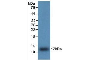 Detection of Recombinant IL8, Human using Polyclonal Antibody to Interleukin 8 (IL8) (IL-8 anticorps  (AA 28-99))
