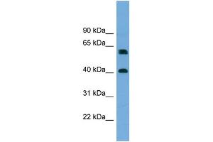 WB Suggested Anti-TERF2IP  Antibody Titration: 0. (RAP1 anticorps  (Middle Region))