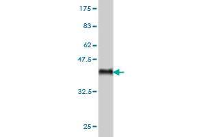 Western Blot detection against Immunogen (36. (ARAF anticorps  (AA 151-250))