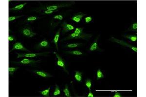Immunofluorescence of monoclonal antibody to OXSR1 on HeLa cell. (OXSR1 anticorps  (AA 351-450))
