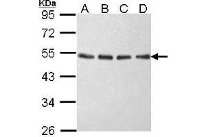 WB Image Sample (30 ug of whole cell lysate) A: 293T B: A431 , C: H1299 D: Hela 10% SDS PAGE antibody diluted at 1:1000