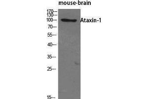 Western Blotting (WB) image for anti-Ataxin 1 (ATXN1) (Tyr1021) antibody (ABIN3183406) (Ataxin 1 anticorps  (Tyr1021))