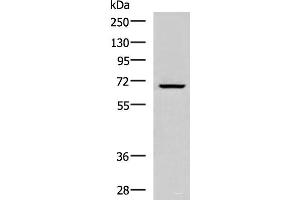 Western blot analysis of Raji cell lysate using CACNB1 Polyclonal Antibody at dilution of 1:800 (CACNB1 anticorps)