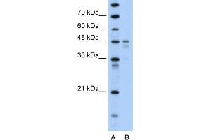 WB Suggested Anti-PDK4 Antibody Titration:  0. (PDK4 anticorps  (N-Term))