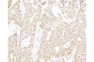anti-Polymerase (RNA) II (DNA Directed) Polypeptide C, 33kDa (POLR2C) (AA 225-275) antibody