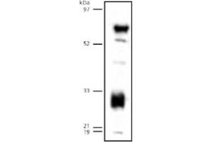 Western blot analysis of LIPG on human endothelial lipase detected in transfected 293 lysates using LIPG polyclonal antibody . (LIPG anticorps  (C-Term))