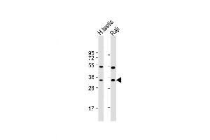 Western Blot at 1:1000 dilution Lane 1: human testis lysate Lane 2: Raji whole cell lysate Lysates/proteins at 20 ug per lane. (HSD17B3 anticorps  (AA 89-118))