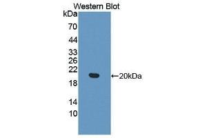 Western Blotting (WB) image for anti-Meningioma Expressed Antigen 5 (Hyaluronidase) (MGEA5) (AA 6-240) antibody (ABIN1172145) (MGEA5 anticorps  (AA 6-240))