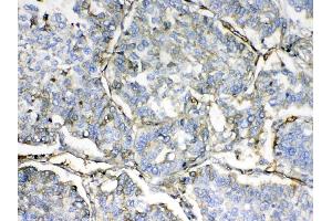 IHC analysis of HBD using anti-HBD antibody .