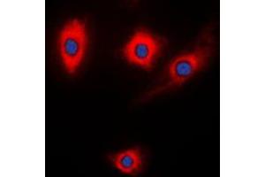 Immunofluorescent analysis of Kalirin staining in NIH3T3 cells.
