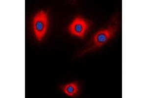 Immunofluorescent analysis of Kalirin staining in NIH3T3 cells. (KALRN anticorps  (Center))