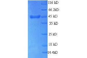 Thyroid Peroxidase (TPO) (AA 22-194) protein (GST tag)