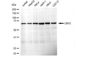 anti-Ubiquitin Specific Peptidase 2 (USP2) antibody