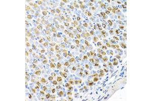 Immunohistochemistry of paraffin-embedded mouse stomach using FECH antibody (ABIN5974679) at dilution of 1/100 (40x lens). (FECH anticorps)