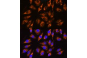 Immunofluorescence analysis of L929 cells using GRK5 Rabbit pAb (ABIN1680115, ABIN3018251, ABIN3018252 and ABIN6220413) at dilution of 1:100 (40x lens).