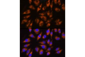 Immunofluorescence analysis of L929 cells using GRK5 Rabbit pAb (ABIN1680115, ABIN3018251, ABIN3018252 and ABIN6220413) at dilution of 1:100 (40x lens). (GRK5 anticorps  (AA 371-590))
