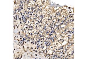 IHC analysis of SRP72 using anti-SRP72 antibody (ABIN7601648).