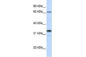 B3GALT1 antibody used at 1 ug/ml to detect target protein.