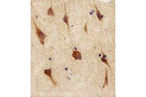 Immunohistochemical analysis of paraffin-embedded H.