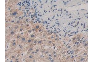 Detection of MAPKAPK2 in Human Liver Tissue using Polyclonal Antibody to MAP Kinase Activated Protein Kinase 2 (MAPKAPK2) (MAPKAP Kinase 2 anticorps  (AA 139-367))