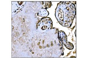 IHC analysis of IGF2R using anti-IGF2R antibody (ABIN7601706).