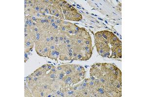 Immunohistochemistry of paraffin-embedded human stomach using THBS2 antibody at dilution of 1:100 (x40 lens). (Thrombospondin 2 anticorps)