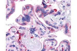 Immunohistochemistry (IHC) image for anti-KIT Ligand (KITLG) (Middle Region) antibody (ABIN2781827)