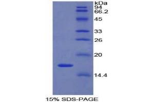 SDS-PAGE analysis of Rat LYAR Protein. (LYAR Protéine)