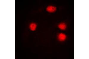 Immunofluorescent analysis of ZIC1/2/3 staining in Jurkat cells. (ZIC1/2/3 anticorps  (Center))